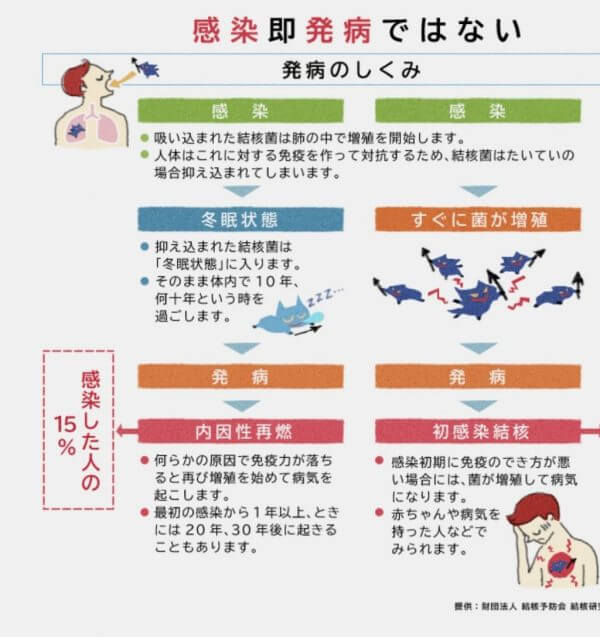 肺結核